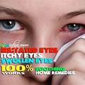 Itchy Eyes Home Remedy