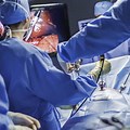 Laparoscopic Hernia Repair Surgery