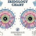 Large Iris Iridology Chart