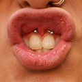 Lip Piercing Inside of Mouth