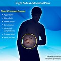 Pain On Right Side of Colon