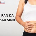 Raan Da Sau Sinh