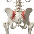 Sacroiliac Joint Pain Diagram