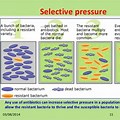 Selection Pressure Examples Biology