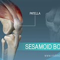 Sesamoid Patella Bone