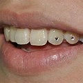 Teeth Jewelry Gold Silver Diamond