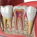 Tooth Root Cross Section