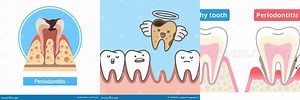 Tooth with Bone Loss Cartoon