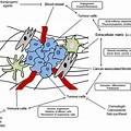 What Is Tumor Stroma