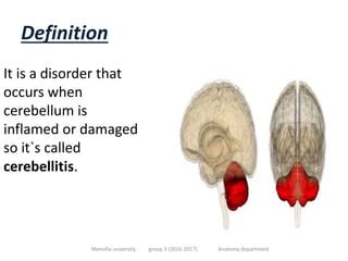 Dysmetria: What It Is, Types, Causes, Symptoms Treatment, 59% OFF