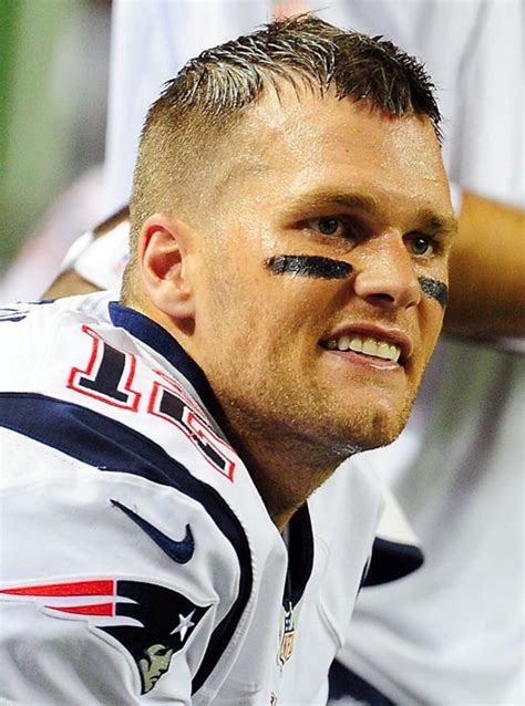 Tom Brady Hair Transplant Before After