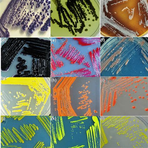 Advantage of microbial production of pigments over chemical synthesis. | Download Scientific Diagram