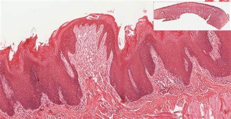 Oral Cavity | histology