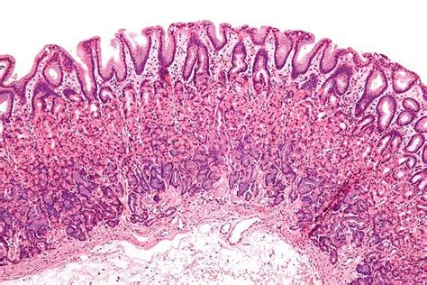 Mucous Membrane (Mucosa) - Definition, Function & Examples