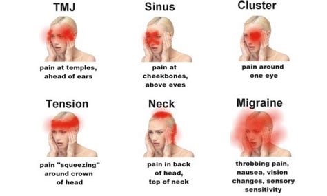 Headache/Migraine: How Osteopathy Can Help | Buxton Osteopathy Clinic