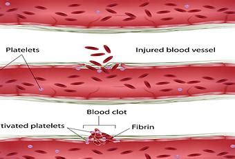 Treatment of Afibrinogenemia in Ayueveda - Paperblog