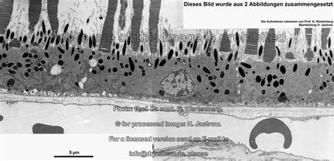 pigment cells Dr.Jastrow's electron microscopic atlas