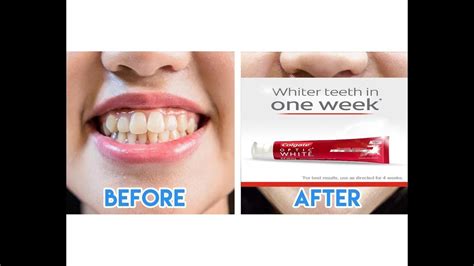 How Does Whitening Toothpaste Work