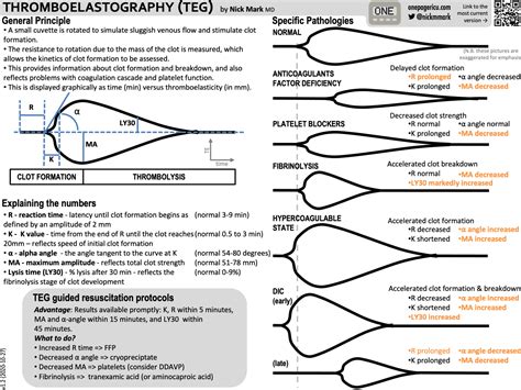 ICU One Pager