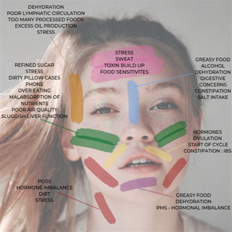 Most Common Non-Hormonal Acne Triggers