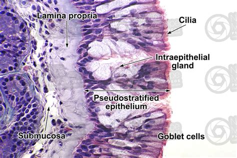 Man. Nasal mucous membrane. Vertical section. 500X - Man - Mammals - Respiratory system - Other ...