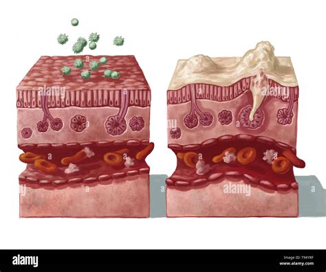 Mucous Membrane High Resolution Stock Photography and Images - Alamy