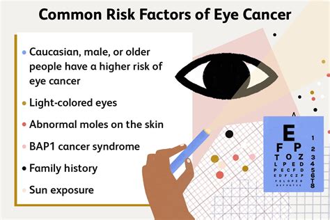 Eye Cancer: Types, Diagnosis, and Treatment