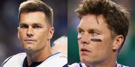 Tom Brady's Hair Transplant: Facts and Details - Hair System