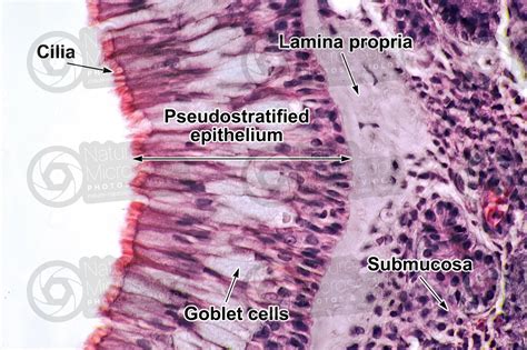 Man. Nasal mucous membrane. Vertical section. 500X - Man - Mammals - Respiratory system - Other ...