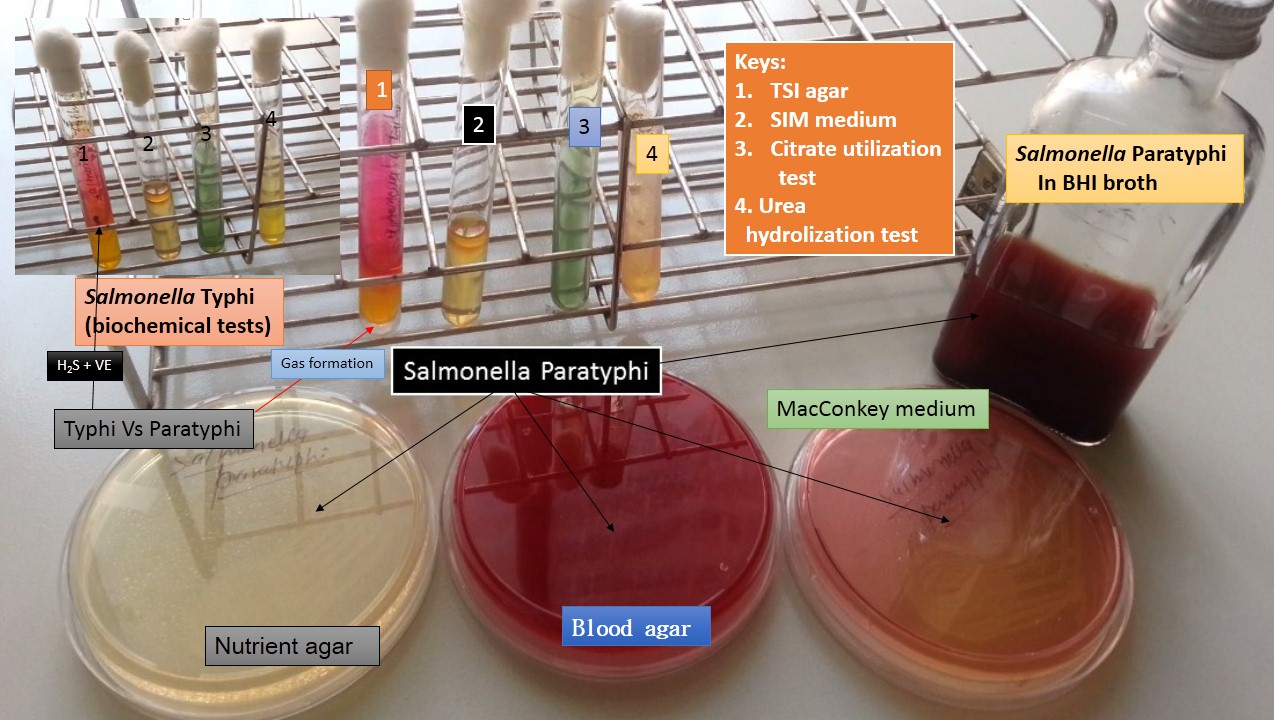 Salmonella Typhi Culture