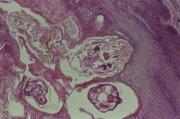 Sarcoptes Scabies in Dog Skin