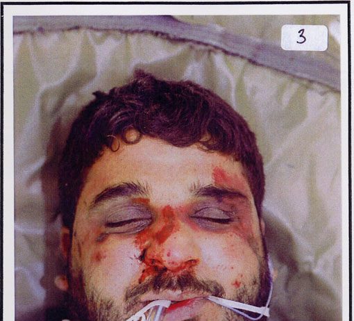 The badly beaten face of Baha Mousa