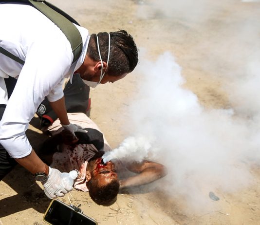 Palestinian shot in the face with a tear gas canister – Israel is accused of war crimes against Palestinians