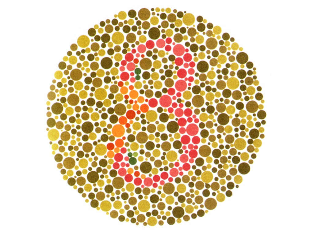 Optic Neuritis