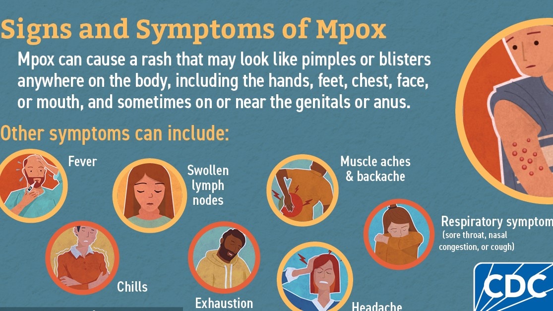 Signs and symptoms of mpox may include rash, fever, and other symptoms