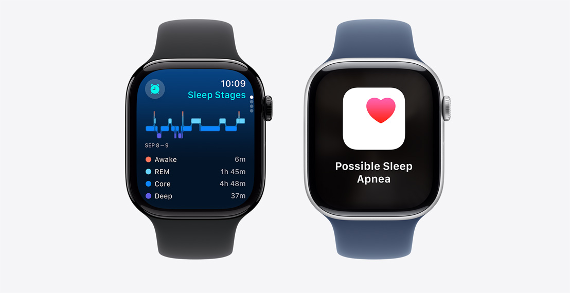 Two Apple Watch Series 10. The first shows Sleep Stages data. The second shows a Possible Sleep Apnea notification.