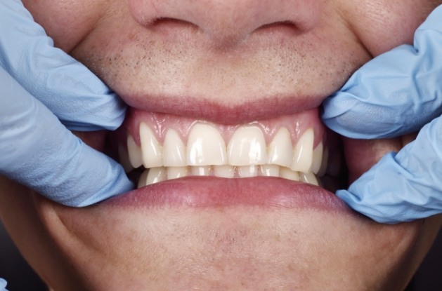 Dentist examining the gums of a patient