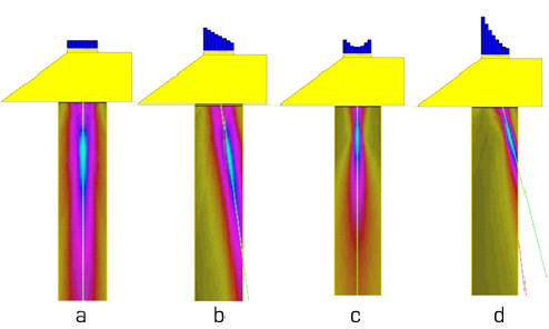 Beam Steering Phased Array Ultrasound - The Best Picture Of Beam