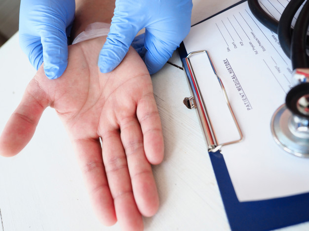 Diagnosing CMC arthritis