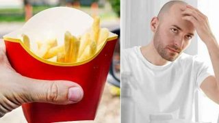 New Research Shows McDonald’s Fries May Actually Help Cure Baldness