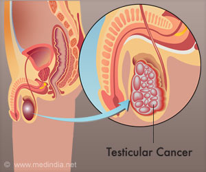 Standardized Care Help Equalize Health Outcomes Among Patients with Testicular Cancer
