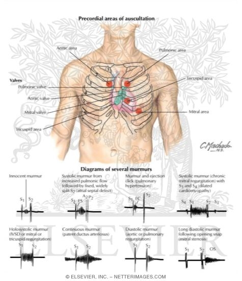 Chest Auscultation Areas