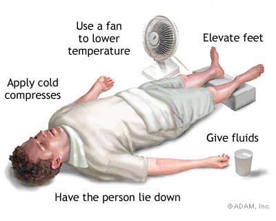 Symptoms of Heat Stroke | RHSB