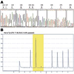 Thumbnail of DNA sequence electropherograms for neuraminidase (NA) gene sequences. A) Analysis of molecular markers (V116, I117, E119, Q136, K150, D151, D198, I223, H275, and N295) for oseltamivir and/or zanamivir resistance among the pandemic (H1N1) 2009 virus isolates. The oseltamivir resistance–conferring mutation CAC (histidine) to TAC (tyrosine) at position 275 was detected in the InDRE797 sample. B) Detection of the H275Y mutation in the NA of the viruses by single-nucleotide polymorphism