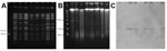 Thumbnail of Molecular typing of Staphylococcus aureus strains, Brazil. A) SmaI digestion of total DNA, followed by pulsed-field gel electrophoresis. Lane M, lambda ladder (molecular masses are indicated in kilobases on the left); lane 1, vancomycin-susceptible, methicillin-resistant S. aureus (VS-MRSA) isolated from the blood of a Brazilian patient (1); lane 2, vancomycin-resistant MRSA (VR-MRSA) isolated from the same patient and blood culture (1); lane 3, transconjugant 1 obtained from a mati