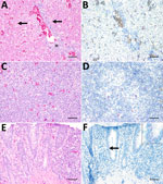 Histopathologic findings and fluorescence in situ hybridization (FISH) results in a deceased zoo-dwelling, Umatilla virus (UMAV)–infected penguin, Germany, 2019. A) Hematoxylin and eosin (H&E) stain of liver tissue shows mild, multifocal, randomly distributed, coagulative necrosis of hepatocytes (arrows) and mild-to-moderate, periportal, lymphocytic hepatitis (asterisk). B) FISH of liver tissue shows intracytoplasmically UMAV RNA-positive hepatocytes. C) H&E stain of spleen tissue shows no significant histopathologic alterations. D) FISH of spleen tissue shows multifocal cells within follicle centers, most likely macrophages, tested cytoplasmatically positive for UMAV RNA. E) H&E stain of small intestine tissue shows mild, multifocal necrosis of epithelial cells of the small intestine. () FISH of small intestine tissue shows positive UMAV RNA signal within enterocytes. Inset: Multifocal, granular red signal within cytoplasm of enterocytes. Scale bars indicate 50 µm.