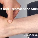 Ankle pain causes and treatment