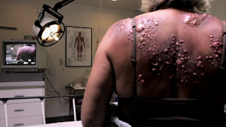 world's-worst-backne-from-The-Bay.jpg world's worst backne from The Bay (2012)