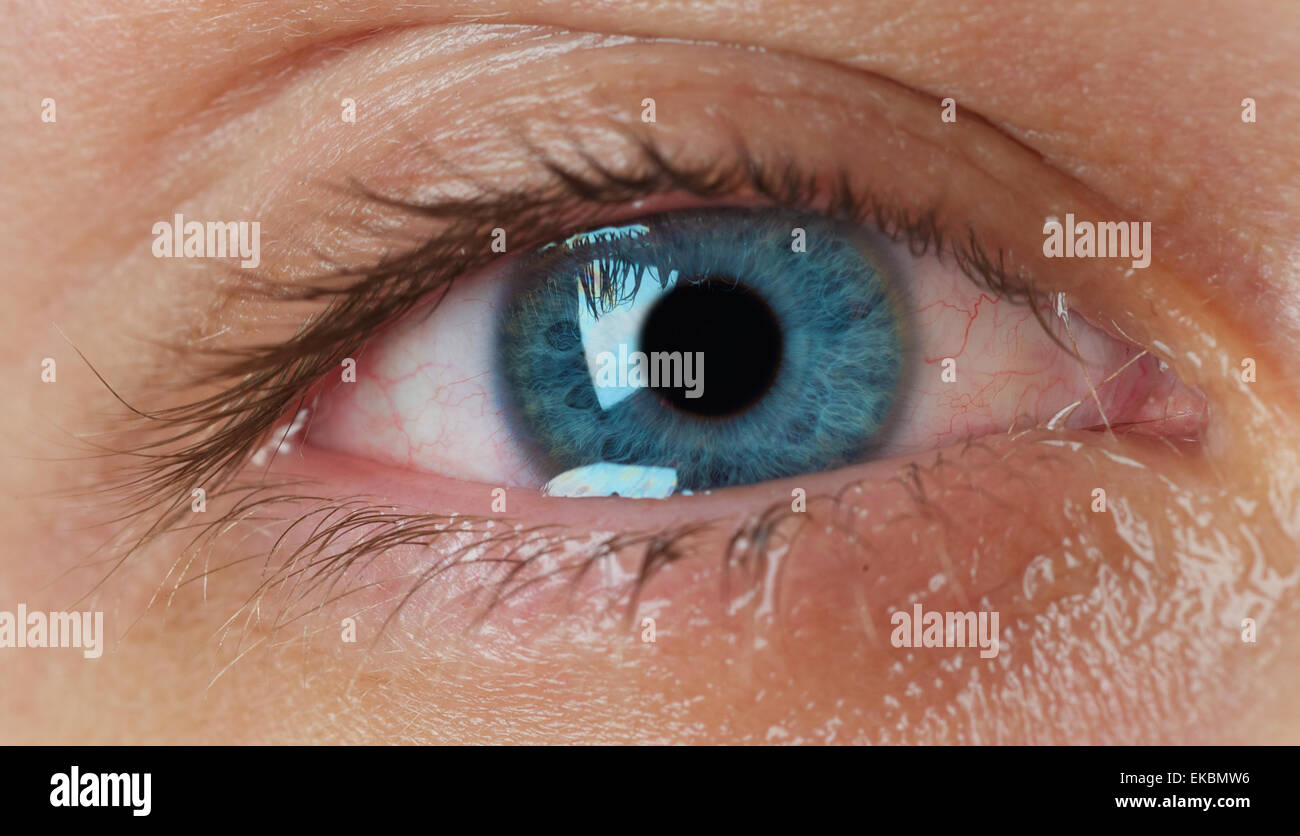 red eye with tears Stock Photo