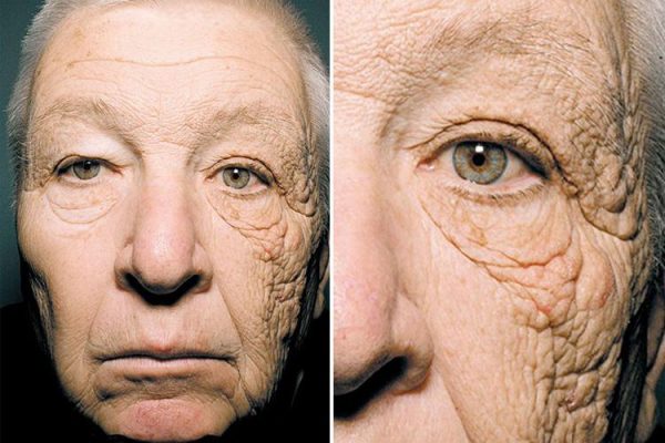 Does Sun Damage Make You Look Older?